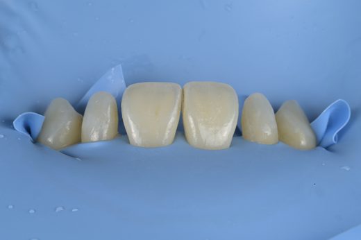 已去識別化臨床照縮圖