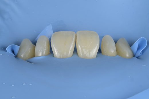 已去識別化臨床照縮圖