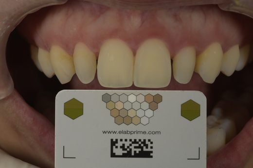 已去識別化臨床照縮圖