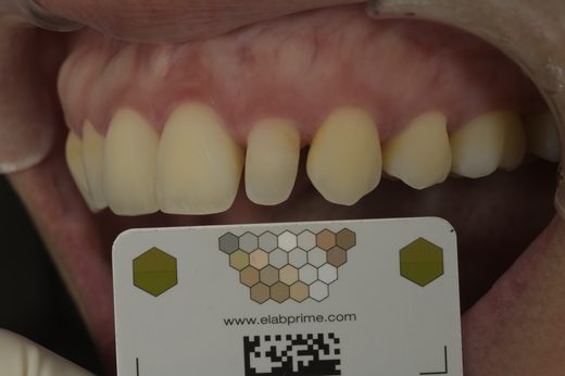 已去識別化臨床照縮圖