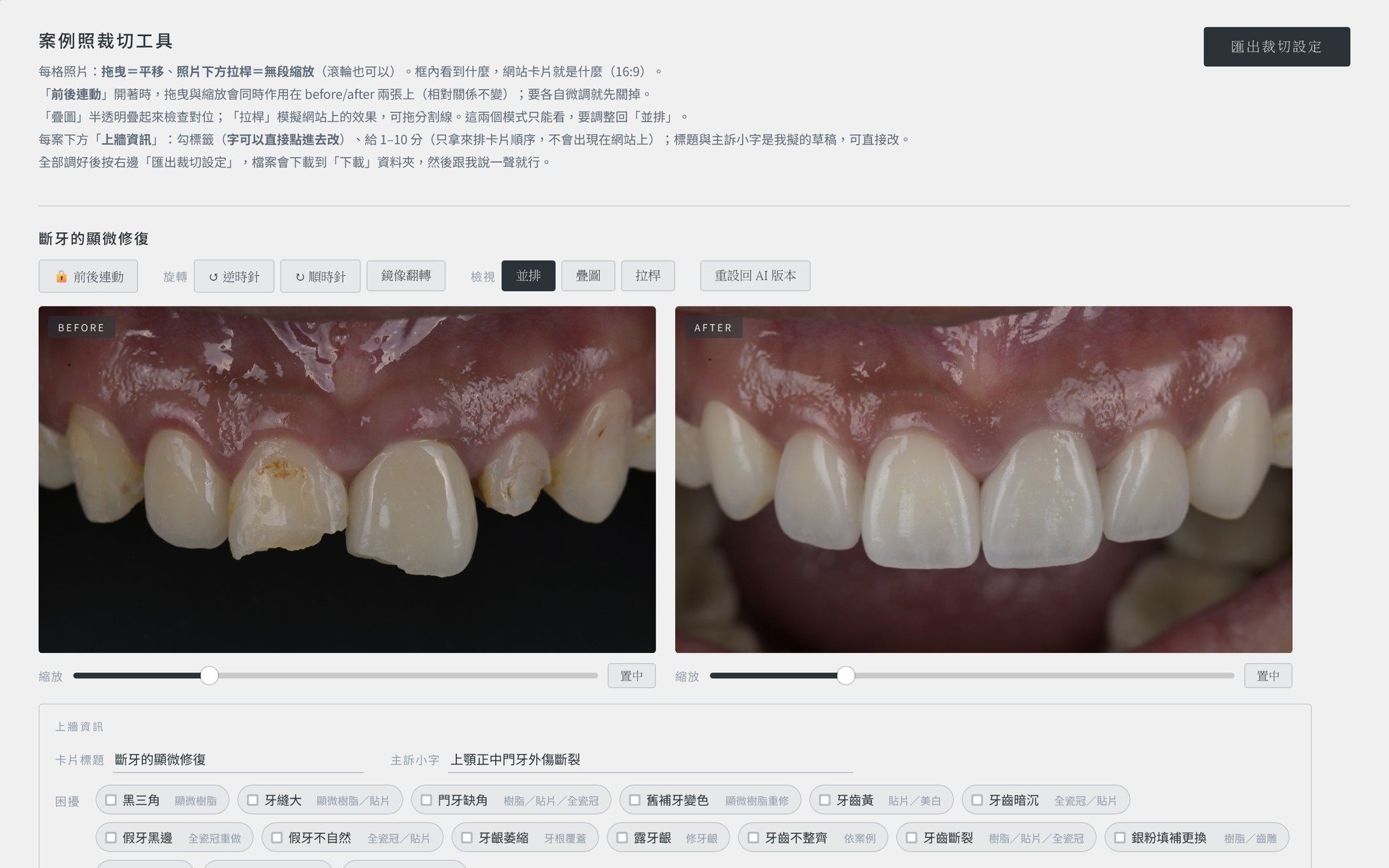 案例上傳小工具